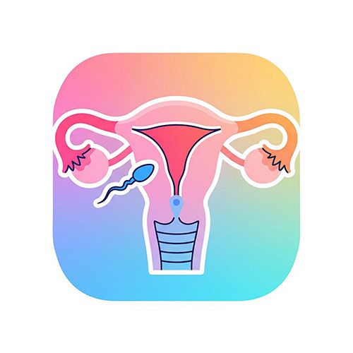 IUI