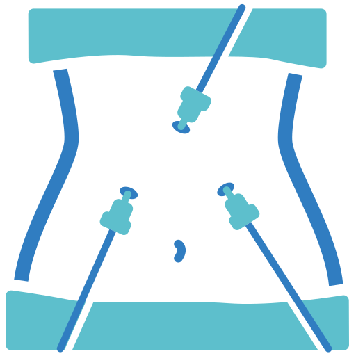 Laparoscopy